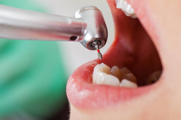 Best After-Hours Emergency Dentist in Charlestown, IN